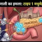 टाइप 1 मधुमेह को समझना
